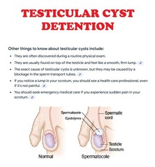 QUISTE TESTICULAR ROMOVEDOR – NO MAS DOLOR – Made in USA – 100% Natural
