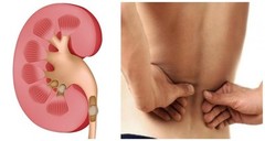 blood pressure – KIDNEY SUPPORT – urinary tract health – 1 Bottle 60 Capsules