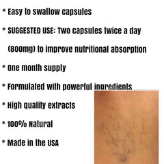 REMOVE VARICOSE VEINS, 120 Capsules, Diosmin and Hesperidin, Biomedical Formula.