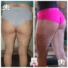 Dúo Curves Kit Moldeo