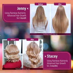 Hair Growth Vitamins for Women | Biotin 10000mcg Collagen Patented OptiMSM g…