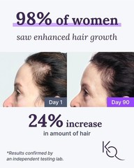Keranique Hair & Scalp Supplements – Promote Strength and Growth Best for Thin