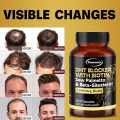 DHT Blocker – Saw Palmetto,Promotes Healthy Hair Growth and Urinary Tract Health