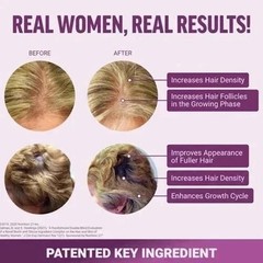 NEW Hair Growth Soft Chews Thicker Stronger Hair 60 Mixed Berry Reduce Wrinkles