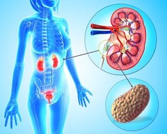 Kidney Herbs – KIDNEY SUPPORT – Kidney Repair 3 Bottles 180 Capsules