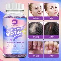 Hair Skin Nails Gummies with 12000mcg Biotin & Collagen Nails Hair Growth